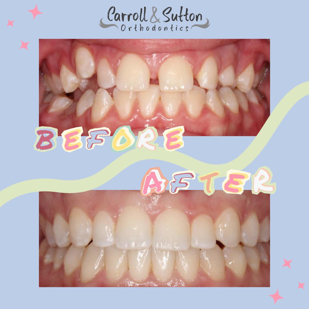 Dr. Aaron Carroll CS Orthodontics
